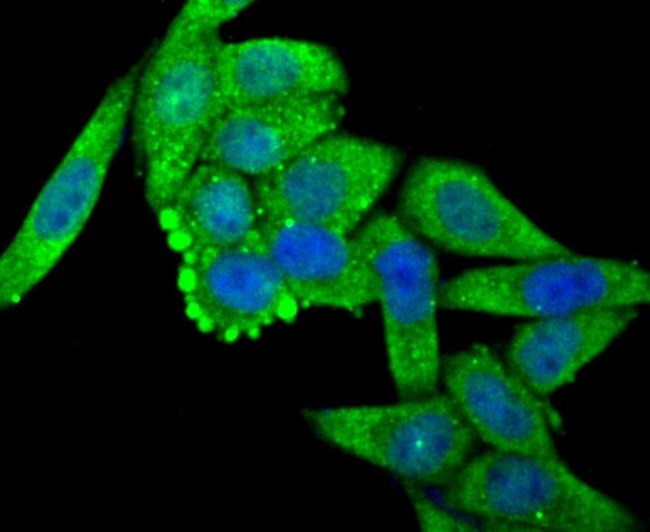 OGT Antibody in Immunocytochemistry (ICC/IF)