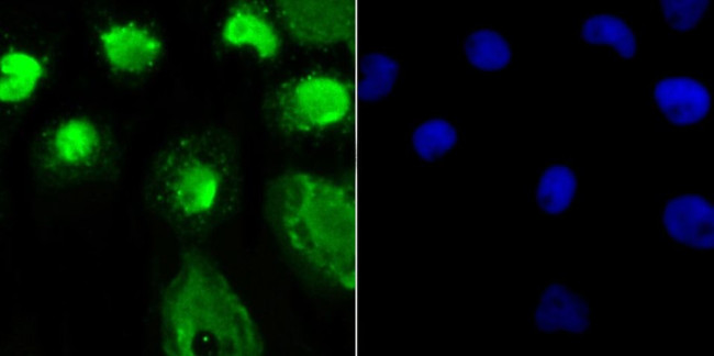 OGT Antibody in Immunocytochemistry (ICC/IF)