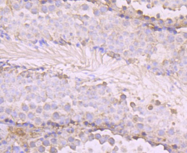 OGT Antibody in Immunohistochemistry (Paraffin) (IHC (P))