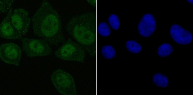 SET Antibody in Immunocytochemistry (ICC/IF)