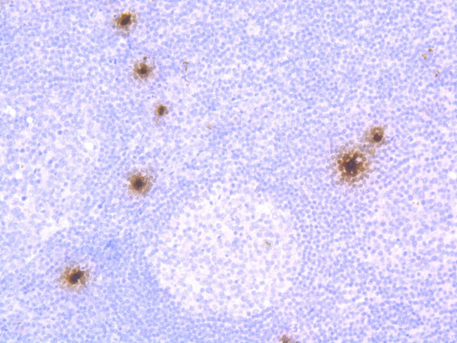 Mast Cell Chymase Antibody in Immunohistochemistry (Paraffin) (IHC (P))