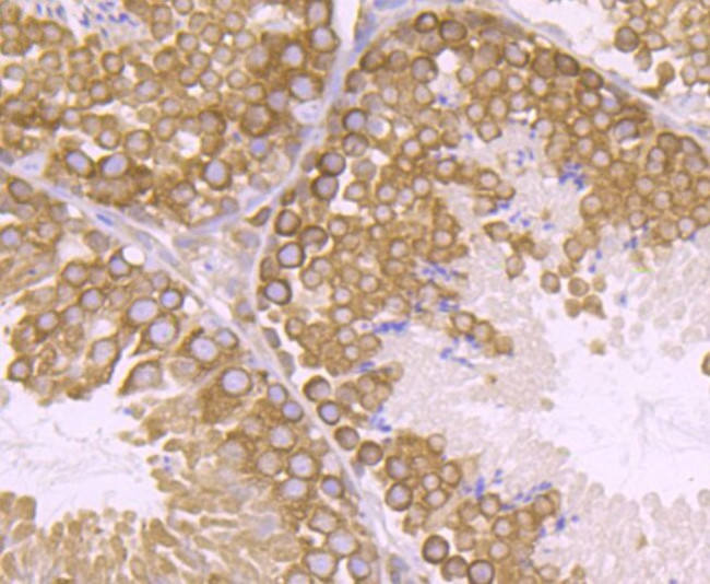 VPS26A Antibody in Immunohistochemistry (Paraffin) (IHC (P))