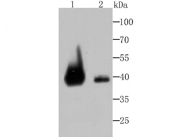 VPS26A Antibody in Western Blot (WB)