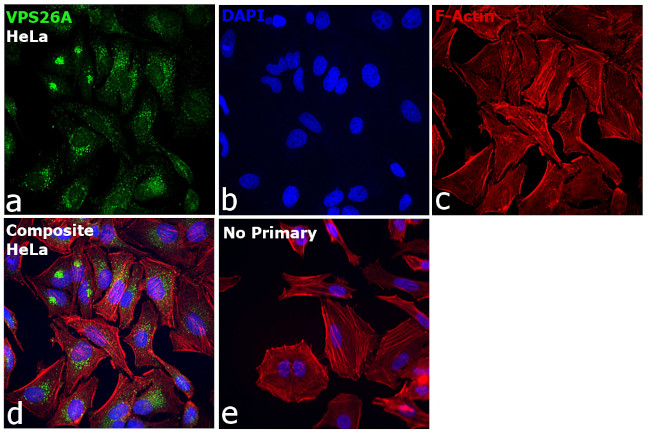 VPS26A Antibody in Immunocytochemistry (ICC/IF)