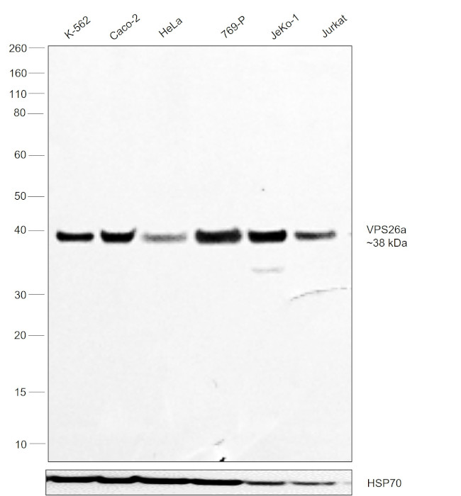 VPS26A Antibody in Western Blot (WB)