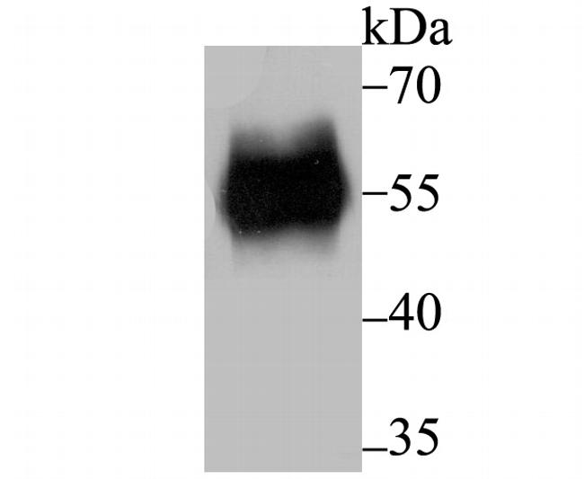 RBPJ Antibody in Western Blot (WB)