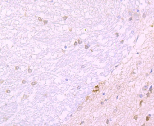 JAB1 Antibody in Immunohistochemistry (Paraffin) (IHC (P))