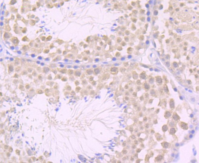 JAB1 Antibody in Immunohistochemistry (Paraffin) (IHC (P))