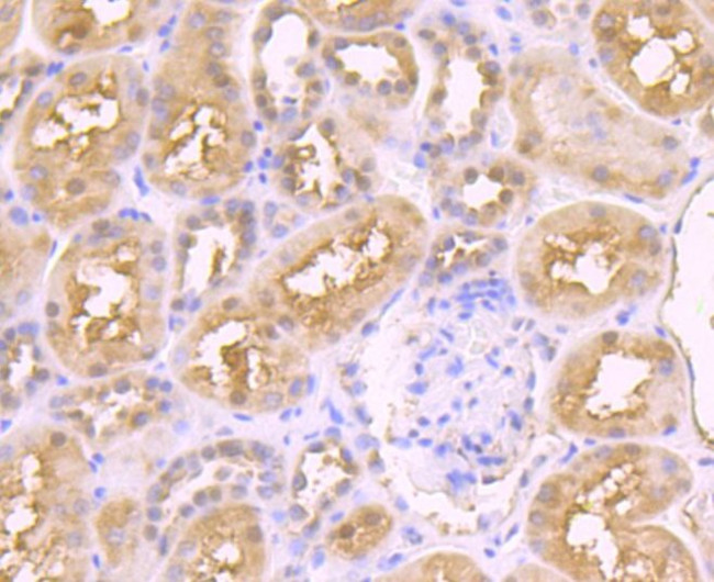 JAB1 Antibody in Immunohistochemistry (Paraffin) (IHC (P))