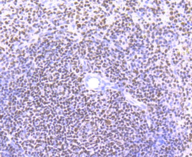 IKAROS Antibody in Immunohistochemistry (Paraffin) (IHC (P))