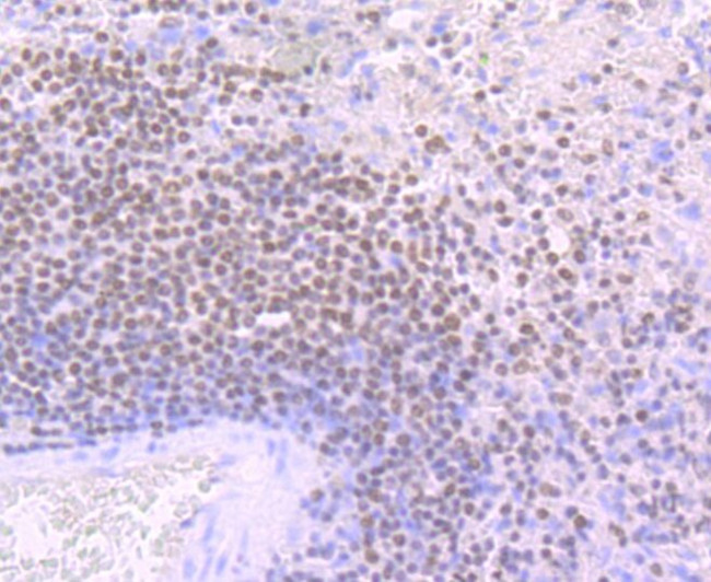 IKAROS Antibody in Immunohistochemistry (Paraffin) (IHC (P))