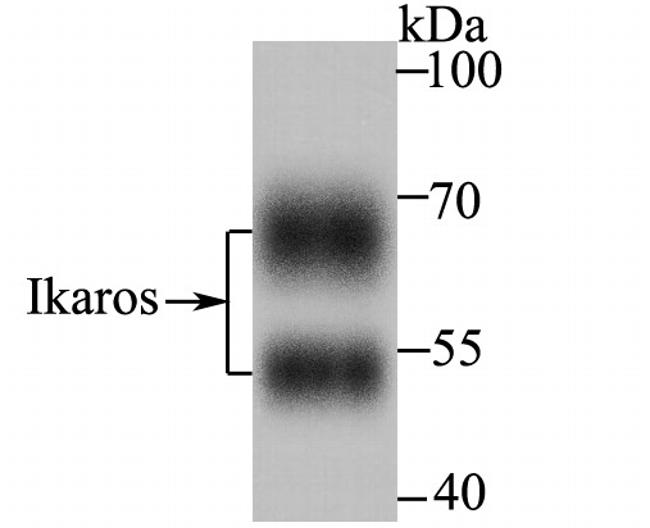 IKAROS Antibody in Western Blot (WB)