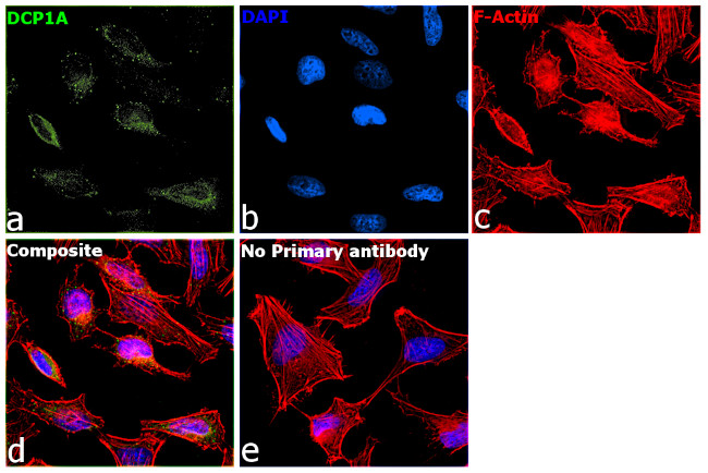 DCP1A Antibody in Immunocytochemistry (ICC/IF)