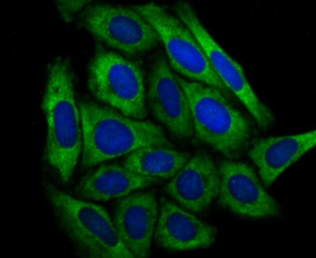 DCP1A Antibody in Immunocytochemistry (ICC/IF)