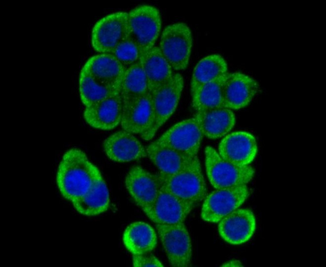 DCP1A Antibody in Immunocytochemistry (ICC/IF)