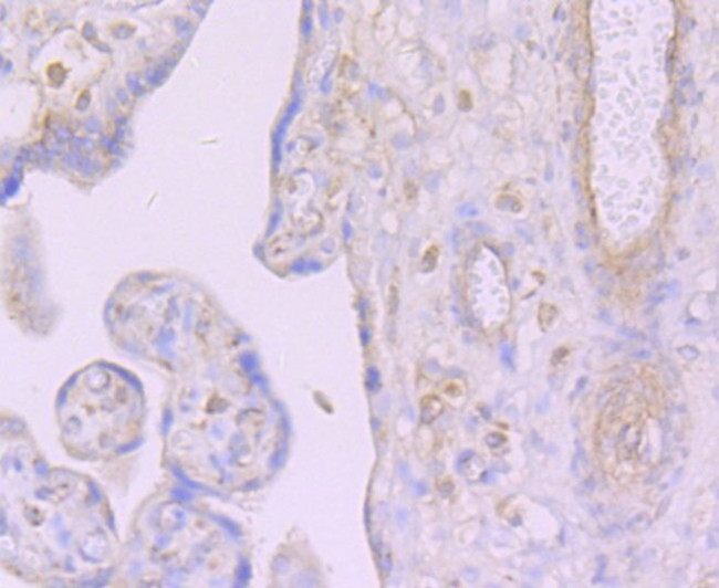 DCP1A Antibody in Immunohistochemistry (Paraffin) (IHC (P))