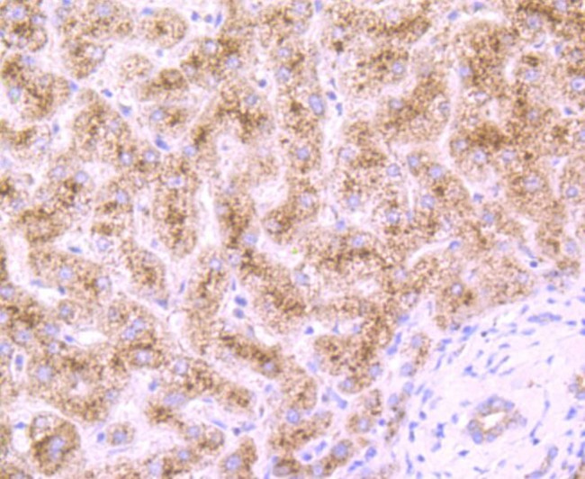 DCP1A Antibody in Immunohistochemistry (Paraffin) (IHC (P))