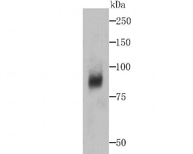 DCP1A Antibody in Western Blot (WB)