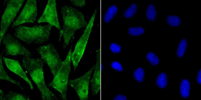 Phospho-alpha Synuclein (Ser129) Antibody in Immunocytochemistry (ICC/IF)