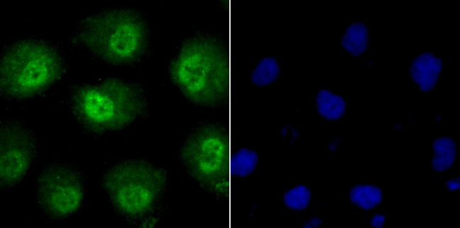 Phospho-alpha Synuclein (Ser129) Antibody in Immunocytochemistry (ICC/IF)