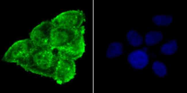 Phospho-alpha Synuclein (Ser129) Antibody in Immunocytochemistry (ICC/IF)