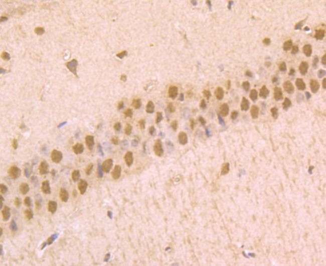 Phospho-alpha Synuclein (Ser129) Antibody in Immunohistochemistry (Paraffin) (IHC (P))