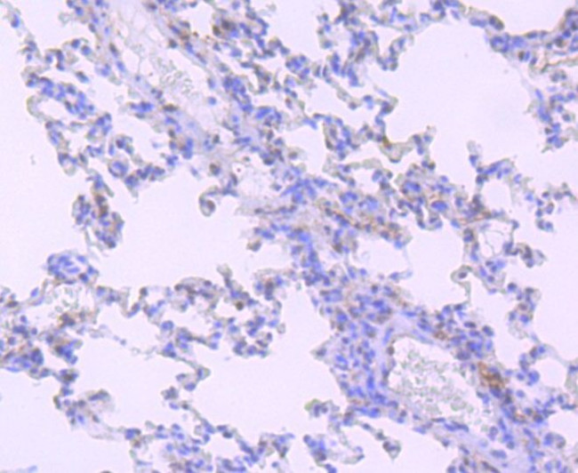 HIF-2 alpha Antibody in Immunohistochemistry (Paraffin) (IHC (P))