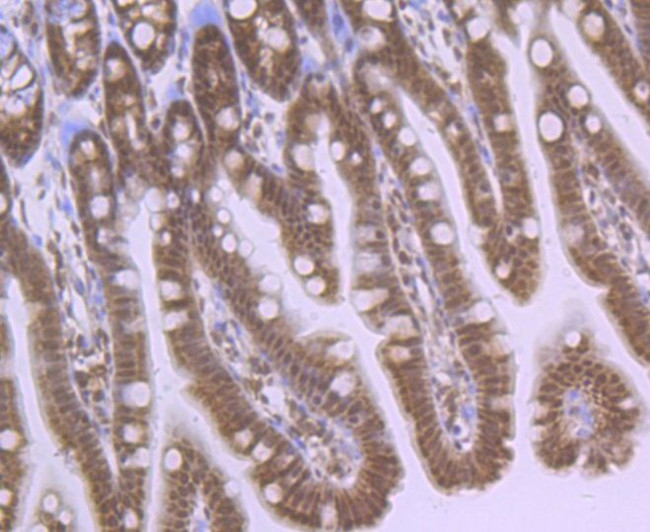 HIF-2 alpha Antibody in Immunohistochemistry (Paraffin) (IHC (P))