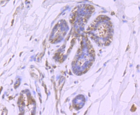 HIF-2 alpha Antibody in Immunohistochemistry (Paraffin) (IHC (P))