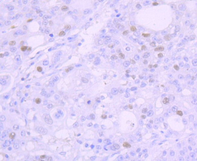 p53 Antibody in Immunohistochemistry (Paraffin) (IHC (P))