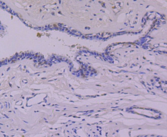 p53 Antibody in Immunohistochemistry (Paraffin) (IHC (P))