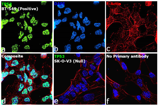 p53 Antibody in Immunocytochemistry (ICC/IF)