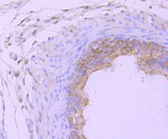 PSMB8 Antibody in Immunohistochemistry (Paraffin) (IHC (P))