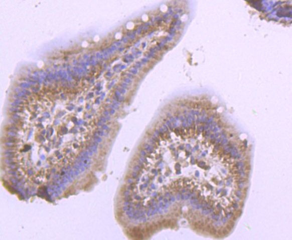 PSMB8 Antibody in Immunohistochemistry (Paraffin) (IHC (P))