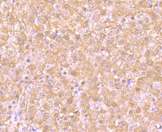 PSMB8 Antibody in Immunohistochemistry (Paraffin) (IHC (P))