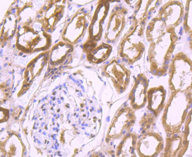 PSMB8 Antibody in Immunohistochemistry (Paraffin) (IHC (P))