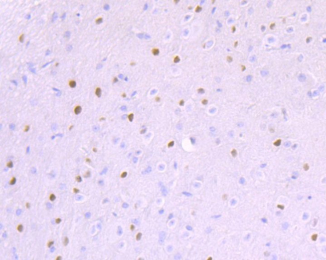 BCL11A Antibody in Immunohistochemistry (Paraffin) (IHC (P))