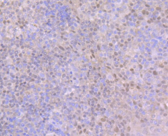 BCL11A Antibody in Immunohistochemistry (Paraffin) (IHC (P))