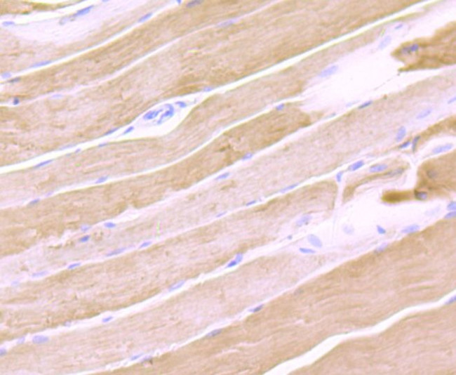 Calsequestrin Antibody in Immunohistochemistry (Paraffin) (IHC (P))