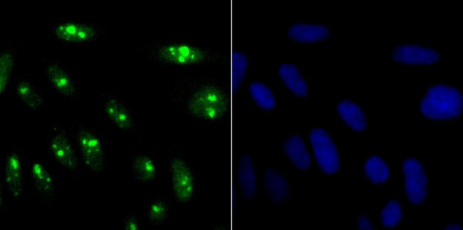 KDM5A Antibody in Immunocytochemistry (ICC/IF)