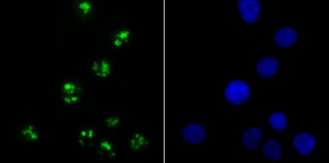 KDM5A Antibody in Immunocytochemistry (ICC/IF)