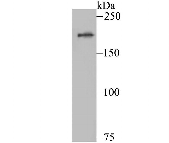 KDM5A Antibody in Western Blot (WB)