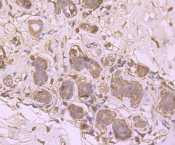 SRC1 Antibody in Immunohistochemistry (Paraffin) (IHC (P))