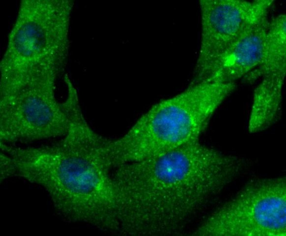 Gelsolin Antibody in Immunocytochemistry (ICC/IF)