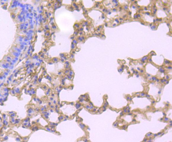 Gelsolin Antibody in Immunohistochemistry (Paraffin) (IHC (P))