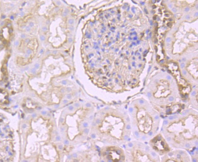 Gelsolin Antibody in Immunohistochemistry (Paraffin) (IHC (P))