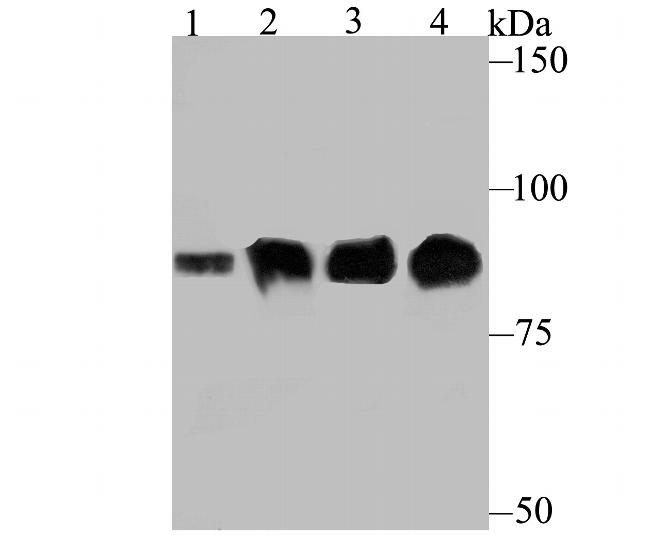 Gelsolin Antibody in Western Blot (WB)