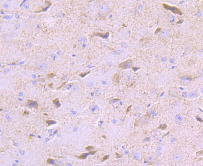 PDK2 Antibody in Immunohistochemistry (Paraffin) (IHC (P))