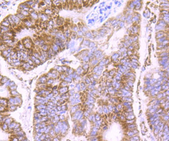 PDK2 Antibody in Immunohistochemistry (Paraffin) (IHC (P))