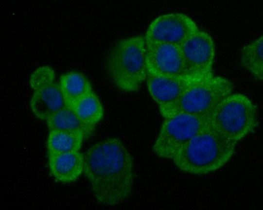 Creatine Kinase MB Antibody in Immunocytochemistry (ICC/IF)